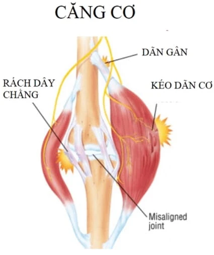 căng-cơ