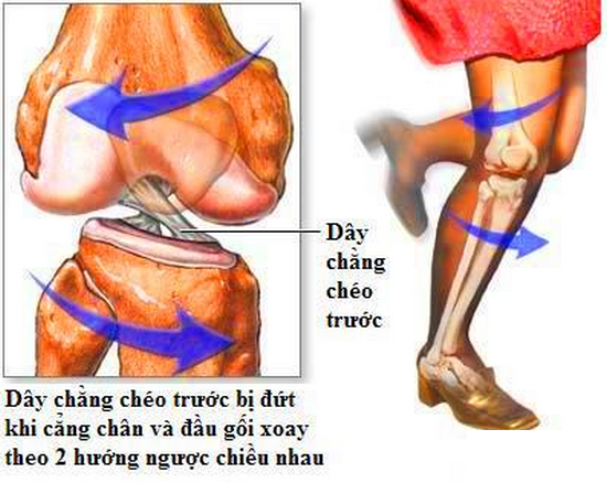 day chang goi 16494078377371060648246