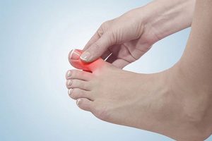 Tê ngón chân là gì?