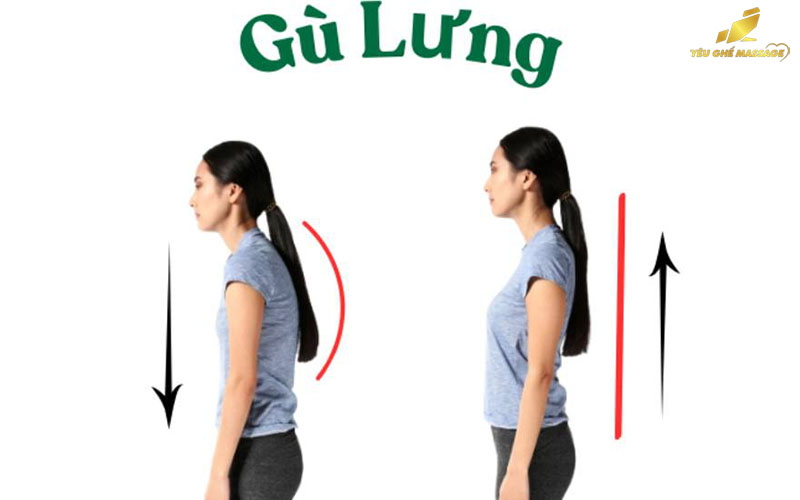 Ghế Massage Có Giúp Giảm Gù Lưng Hay Không