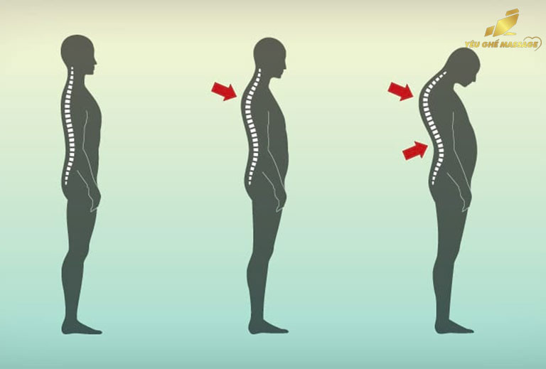 Ghế Massage Có Giúp Giảm Gù Lưng Hay Không