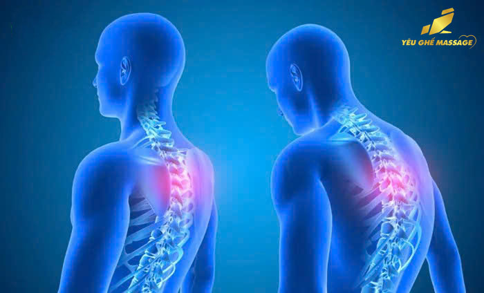 Ghế Massage Có Giúp Giảm Gù Lưng Hay Không